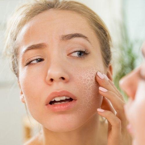 Tackle Dry and Flaky Skin This Winter with These Simple Tips