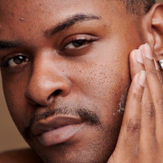 Essential Tips for Managing Oily Skin Effectively