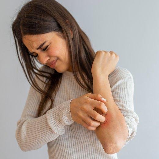 Understanding Eczema: Tips for Smooth Skin and Peace of Mind