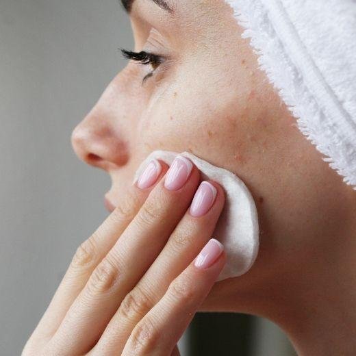 Essential Tips for Managing Acne-Prone Skin Care Routines