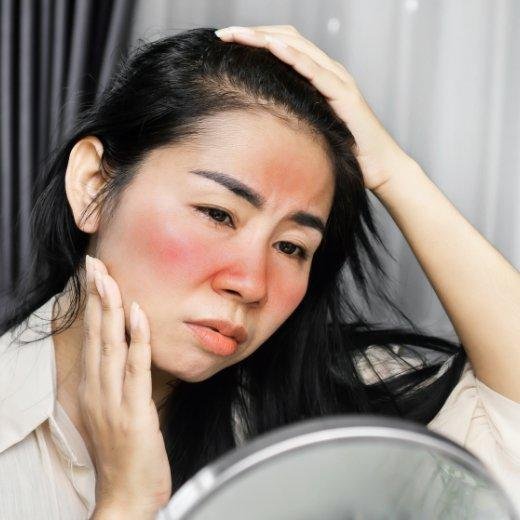 Sunburnt Face