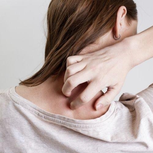 Top Products for Eczema-Prone Skin to Consider