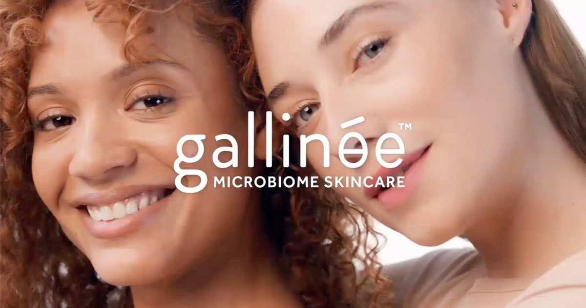 Choosing Between Gallinee and Its Top Competitors